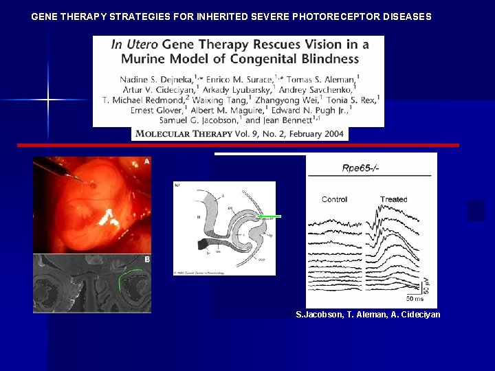 GENE THERAPY STRATEGIES FOR INHERITED SEVERE PHOTORECEPTOR DISEASES S. Jacobson, T. Aleman, A. Cideciyan