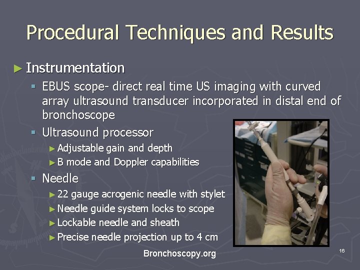 Procedural Techniques and Results ► Instrumentation § EBUS scope- direct real time US imaging Procedural Techniques and Results ► Instrumentation § EBUS scope- direct real time US imaging