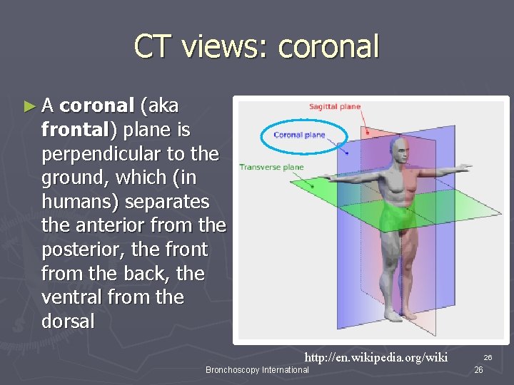 CT views: coronal ►A coronal (aka frontal) plane is perpendicular to the ground, which CT views: coronal ►A coronal (aka frontal) plane is perpendicular to the ground, which