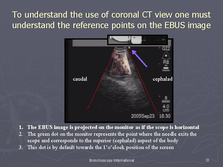 To understand the use of coronal CT view one must understand the reference points To understand the use of coronal CT view one must understand the reference points