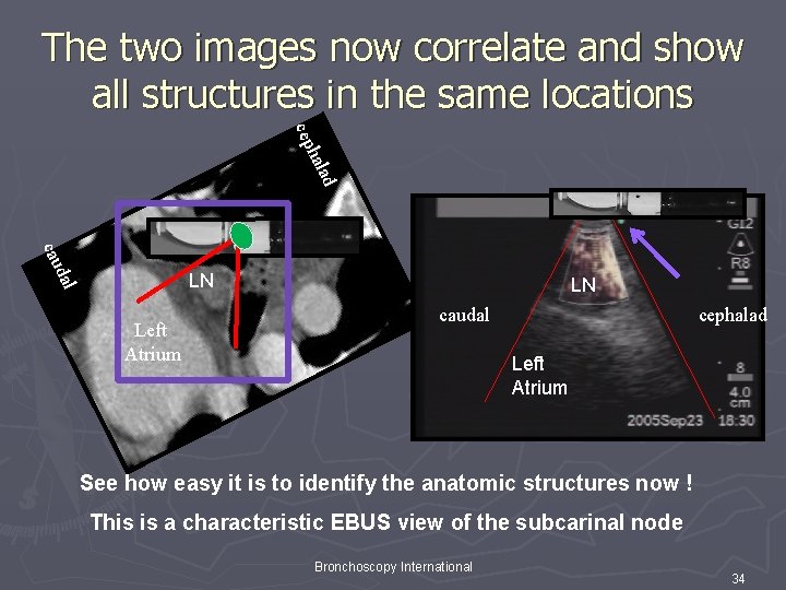 The two images now correlate and show all structures in the same locations hal The two images now correlate and show all structures in the same locations hal