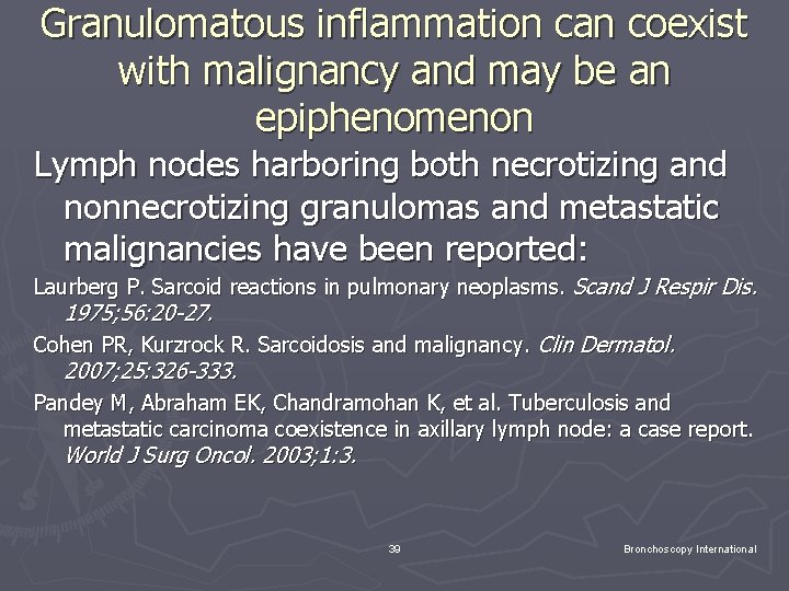 Granulomatous inflammation can coexist with malignancy and may be an epiphenomenon Lymph nodes harboring Granulomatous inflammation can coexist with malignancy and may be an epiphenomenon Lymph nodes harboring