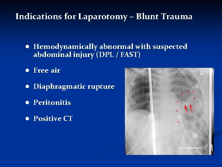 Indications for Laparotomy – Blunt Trauma ● Hemodynamically abnormal with suspected abdominal injury (DPL