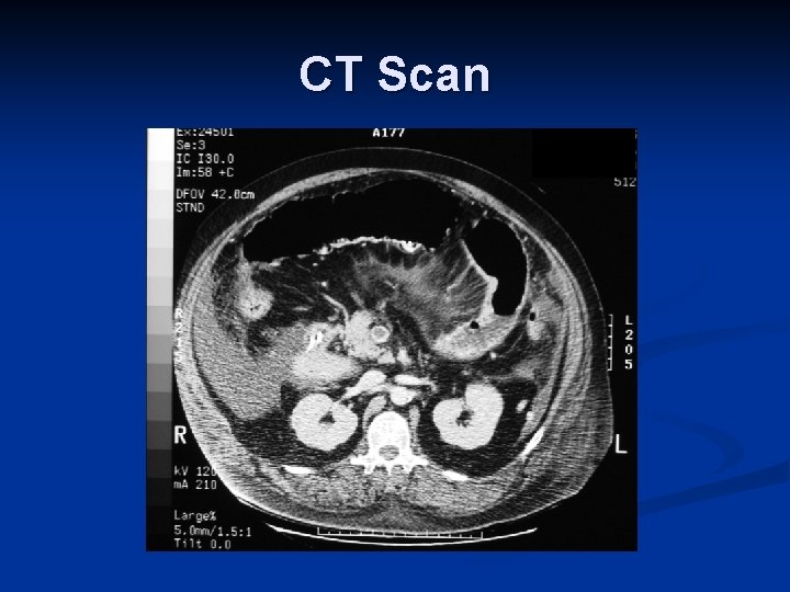 CT Scan 