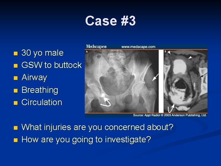 Case #3 n n n n 30 yo male GSW to buttock Airway Breathing