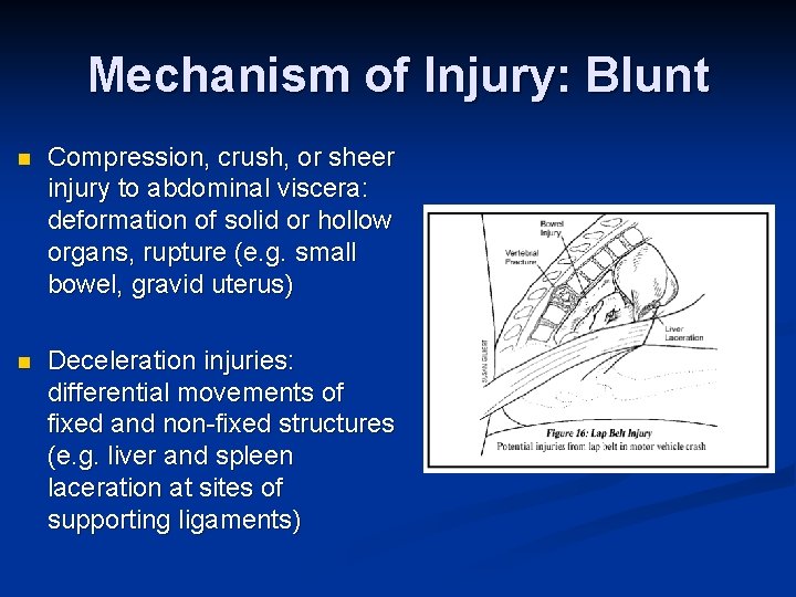 Mechanism of Injury: Blunt n Compression, crush, or sheer injury to abdominal viscera: deformation