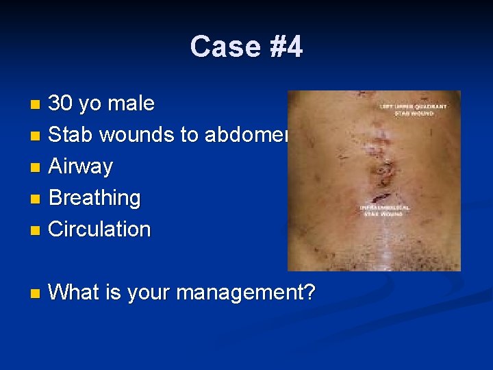 Case #4 30 yo male n Stab wounds to abdomen n Airway n Breathing
