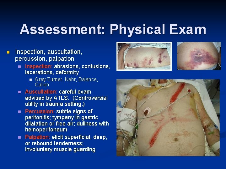 Assessment: Physical Exam n Inspection, auscultation, percussion, palpation n Inspection: abrasions, contusions, lacerations, deformity