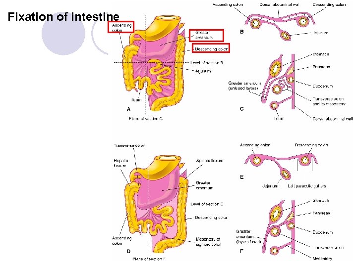 Fixation of intestine 