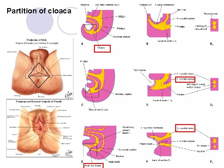 Partition of cloaca 