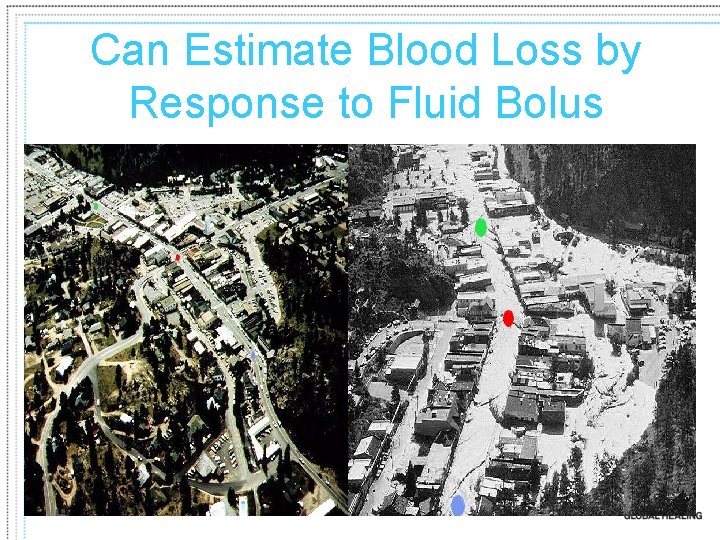 Can Estimate Blood Loss by Response to Fluid Bolus 