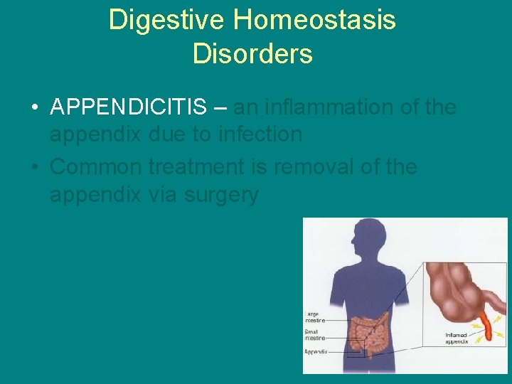 Digestive Homeostasis Disorders • APPENDICITIS – an inflammation of the appendix due to infection