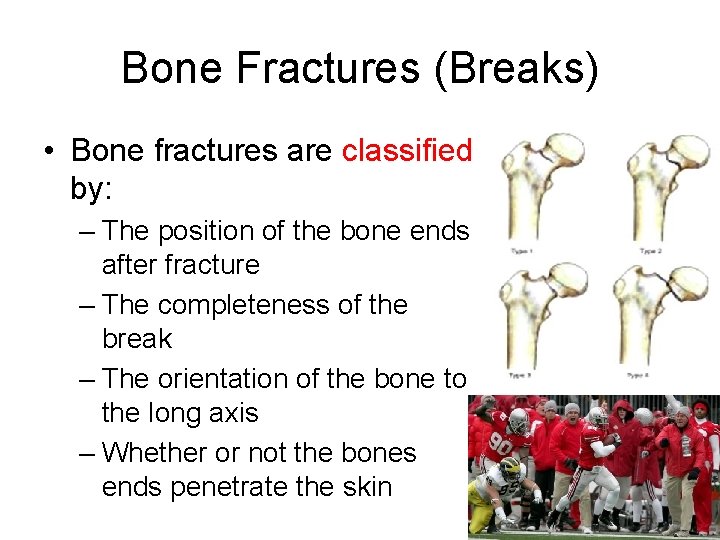 Bone Fractures (Breaks) • Bone fractures are classified by: – The position of the