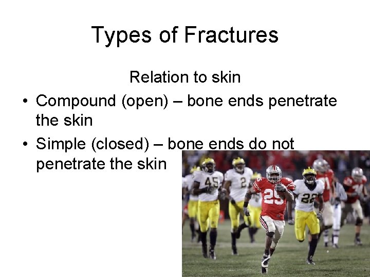 Types of Fractures Relation to skin • Compound (open) – bone ends penetrate the