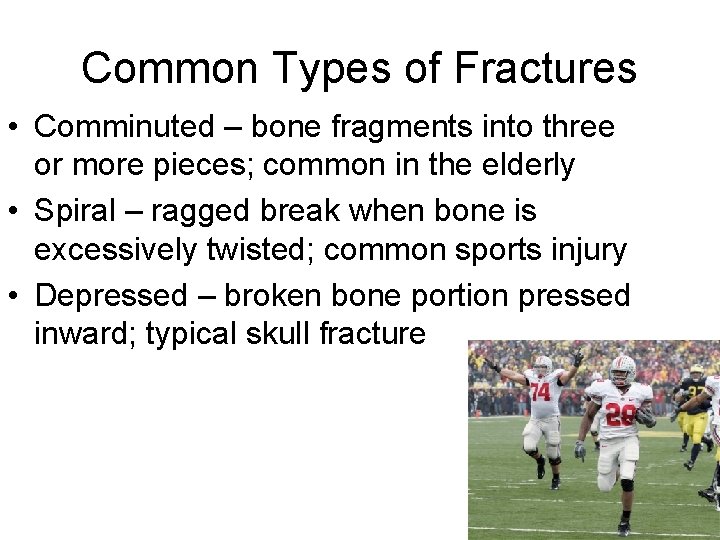 Common Types of Fractures • Comminuted – bone fragments into three or more pieces;