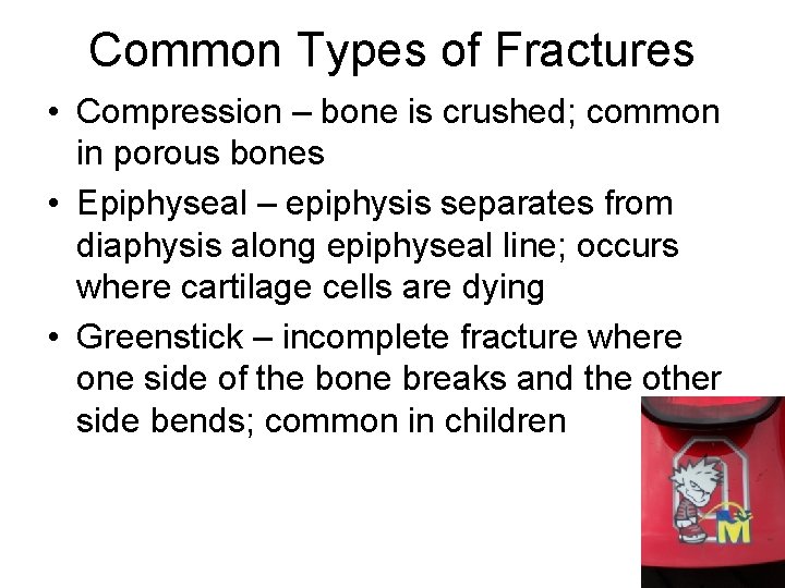 Common Types of Fractures • Compression – bone is crushed; common in porous bones