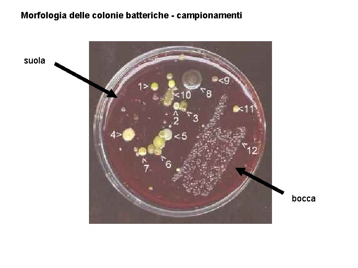 Morfologia delle colonie batteriche - campionamenti suola bocca 