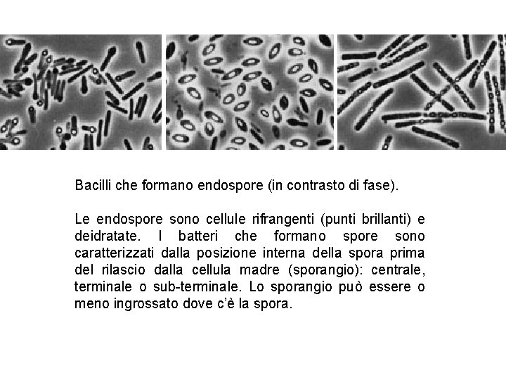 Bacilli che formano endospore (in contrasto di fase). Le endospore sono cellule rifrangenti (punti