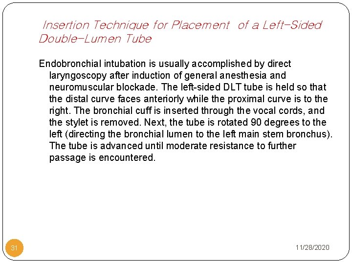 Insertion Technique for Placement of a Left-Sided Double-Lumen Tube Endobronchial intubation is usually accomplished