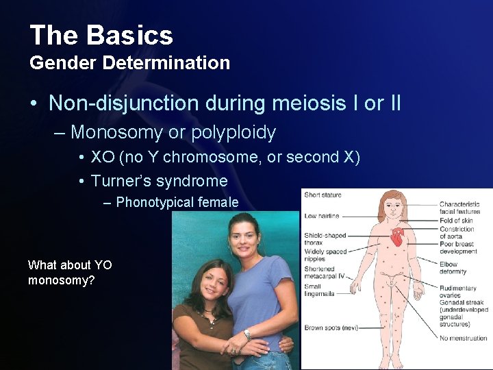 The Basics Gender Determination • Non-disjunction during meiosis I or II – Monosomy or
