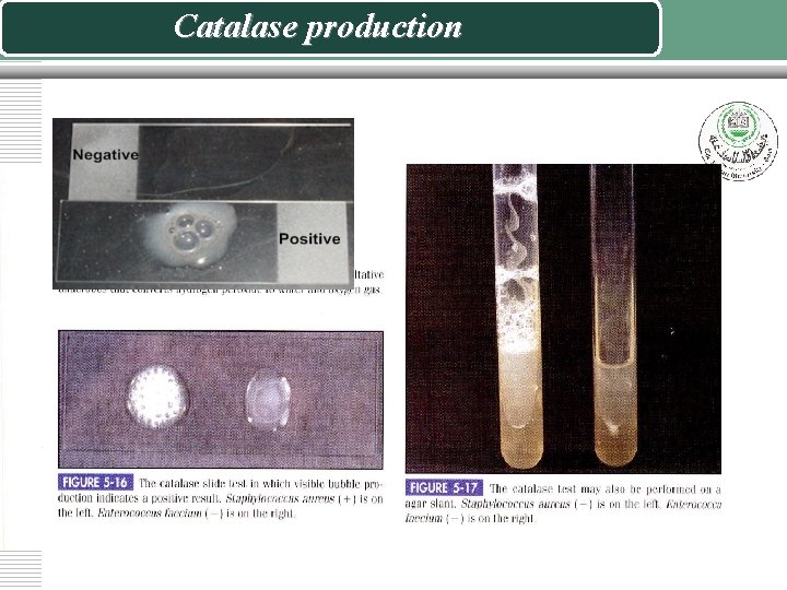 Catalase production 