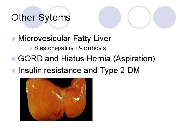 Other Sytems l Microvesicular l Fatty Liver Steatohepatitis +/- cirrhosis l GORD and Hiatus