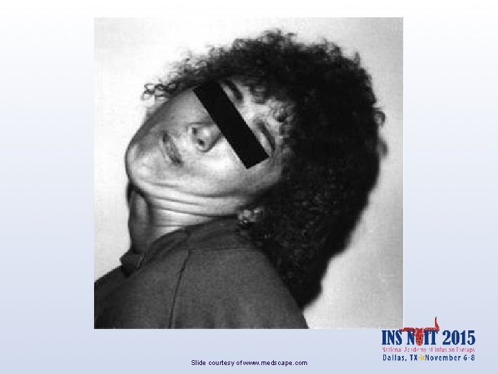 Slide courtesy of www. medscape. com 