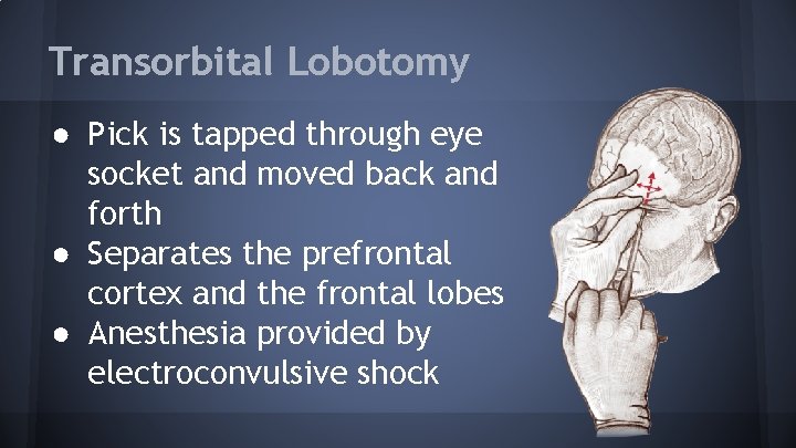 Transorbital Lobotomy ● Pick is tapped through eye socket and moved back and forth