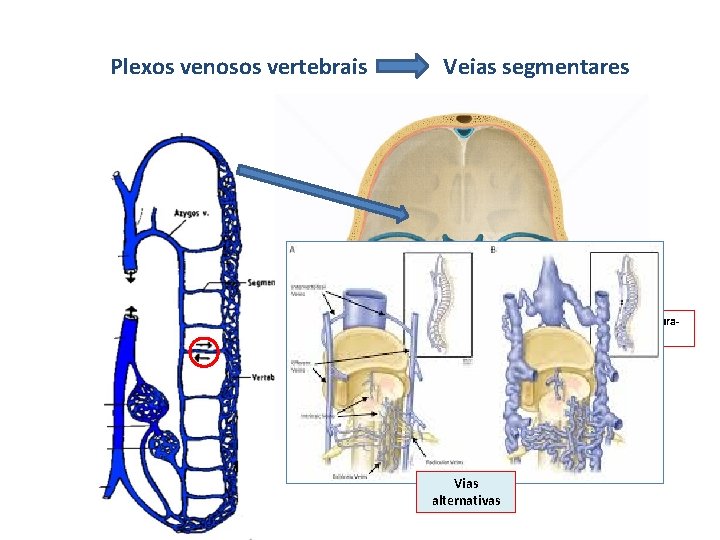 Plexos venosos vertebrais Veias segmentares Plexo basilar Seios da duramáter Vias alternativas 