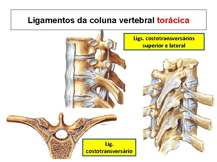 Ligamentos da coluna vertebral torácica Ligs. costotransversários superior e lateral Lig. costotransversário 