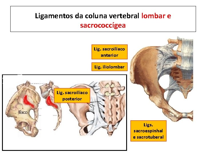 Ligamentos da coluna vertebral lombar e sacrococcígea Lig. sacroilíaco anterior Lig. iliolombar Lig. sacroilíaco