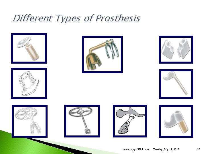 Different Types of Prosthesis www. nayyar. ENT. com Tuesday, July 17, 2012 26 