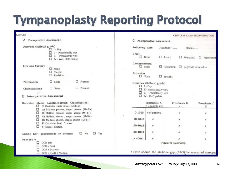 Tympanoplasty Reporting Protocol www. nayyar. ENT. com Tuesday, July 17, 2012 42 