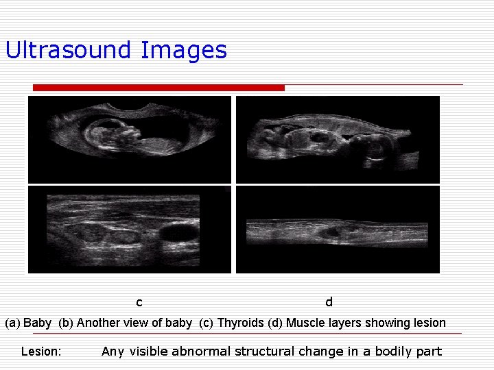 Ultrasound Images a c b d (a) Baby (b) Another view of baby (c)