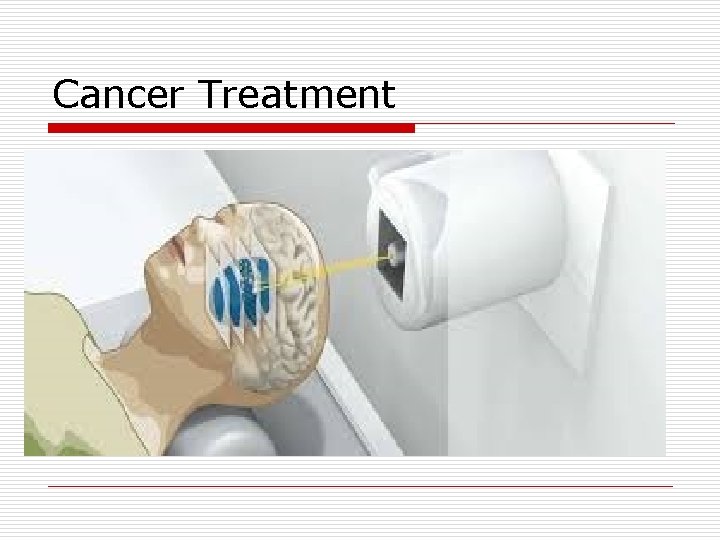 Cancer Treatment 