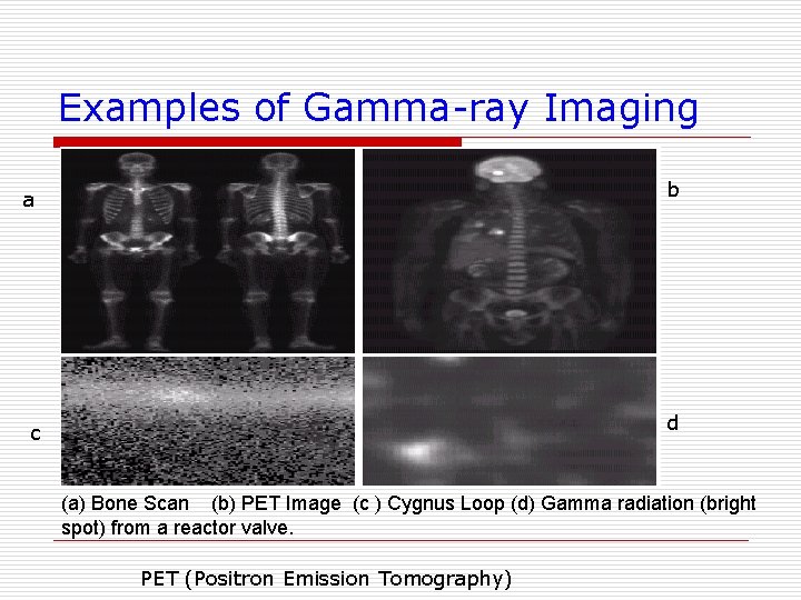 Examples of Gamma-ray Imaging a b c d (a) Bone Scan (b) PET Image