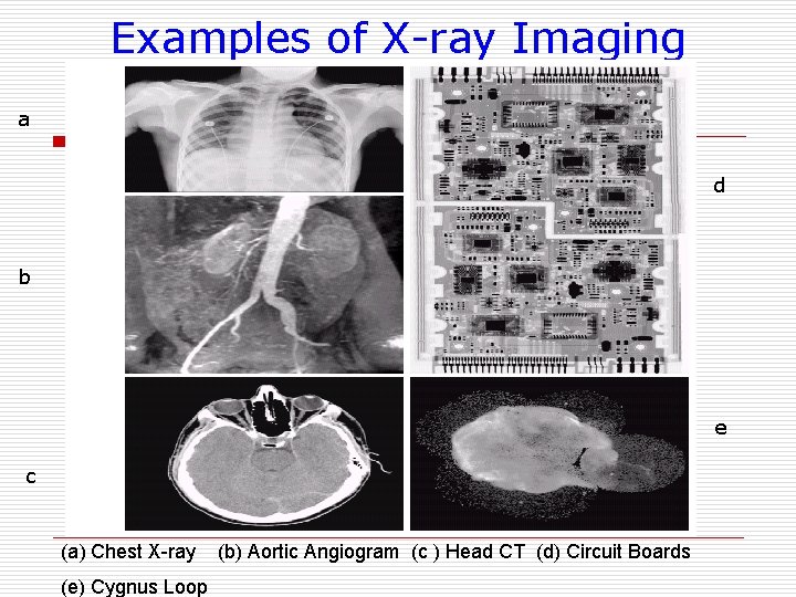 Examples of X-ray Imaging a d b e c (a) Chest X-ray (e) Cygnus