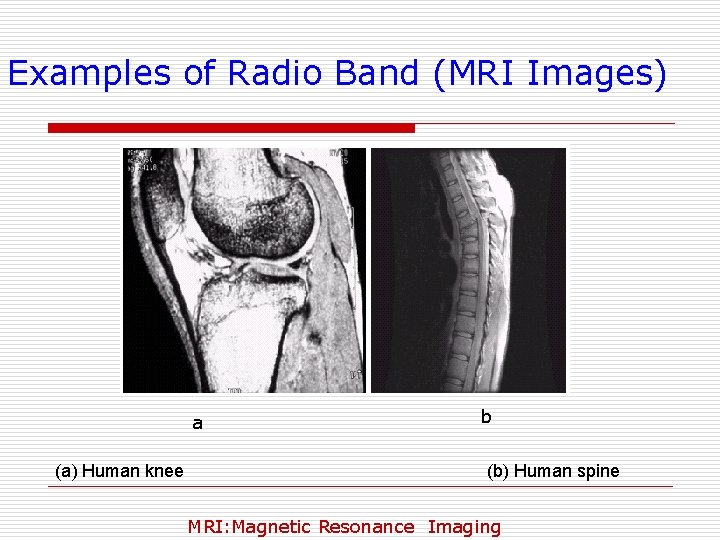 Examples of Radio Band (MRI Images) a (a) Human knee b (b) Human spine