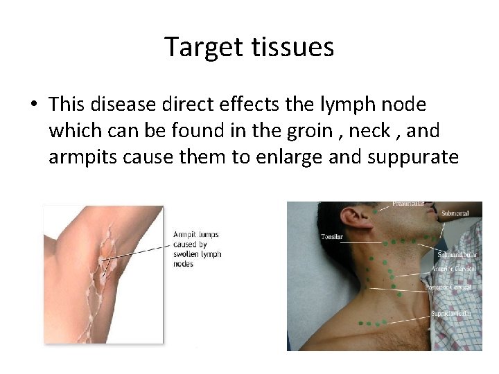 Target tissues • This disease direct effects the lymph node which can be found