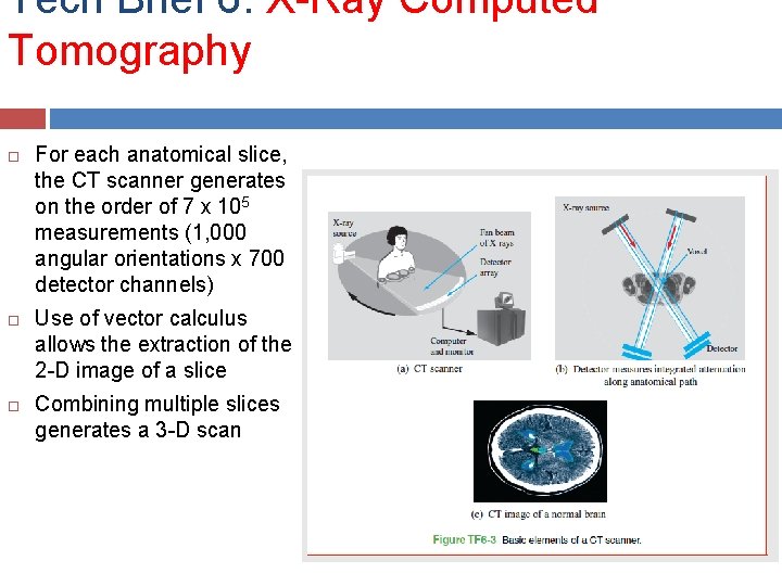 Tech Brief 6: X-Ray Computed Tomography For each anatomical slice, the CT scanner generates