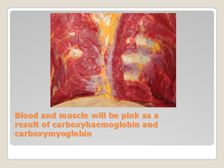 Blood and muscle will be pink as a result of carboxyhaemoglobin and carboxymyoglobin 
