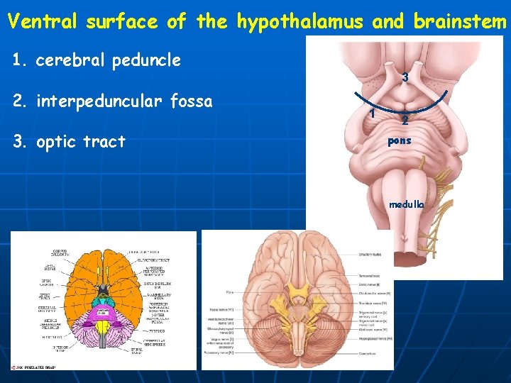 Ventral surface of the hypothalamus and brainstem 1. cerebral peduncle 3 2. interpeduncular fossa