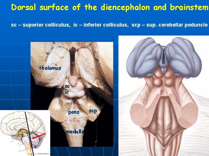 Dorsal surface of the diencephalon and brainstem sc – superior colliculus, ic – inferior