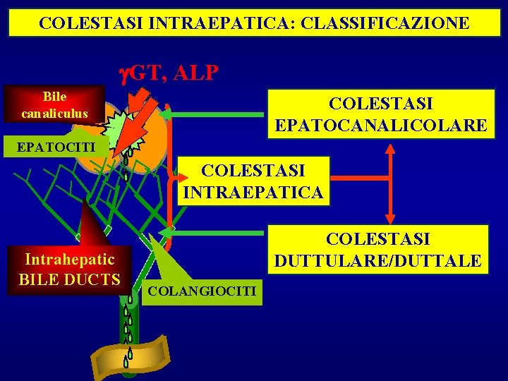 COLESTASI INTRAEPATICA: CLASSIFICAZIONE GT, ALP Bile canaliculus COLESTASI EPATOCANALICOLARE EPATOCITI COLESTASI INTRAEPATICA Intrahepatic BILE