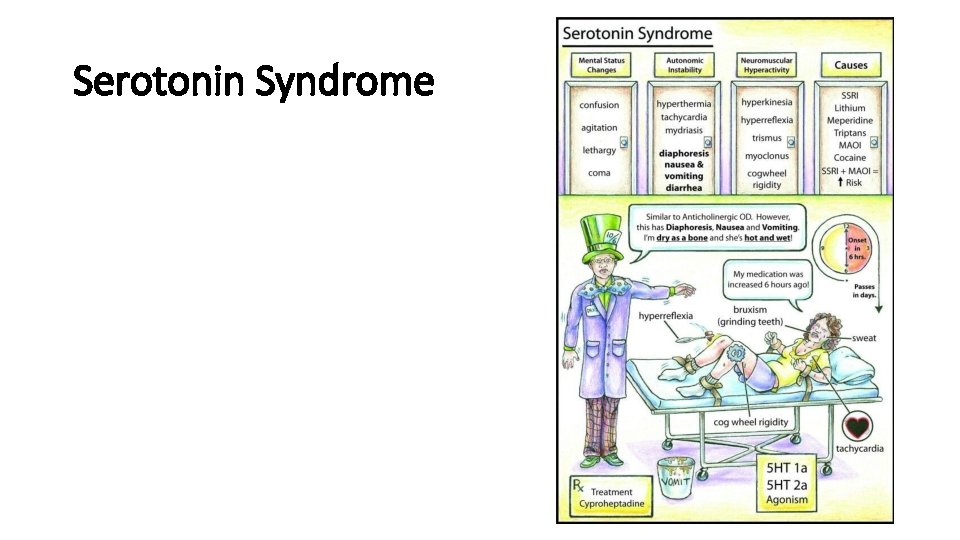 Serotonin Syndrome 