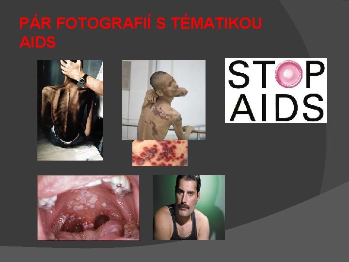 PÁR FOTOGRAFIÍ S TÉMATIKOU AIDS 