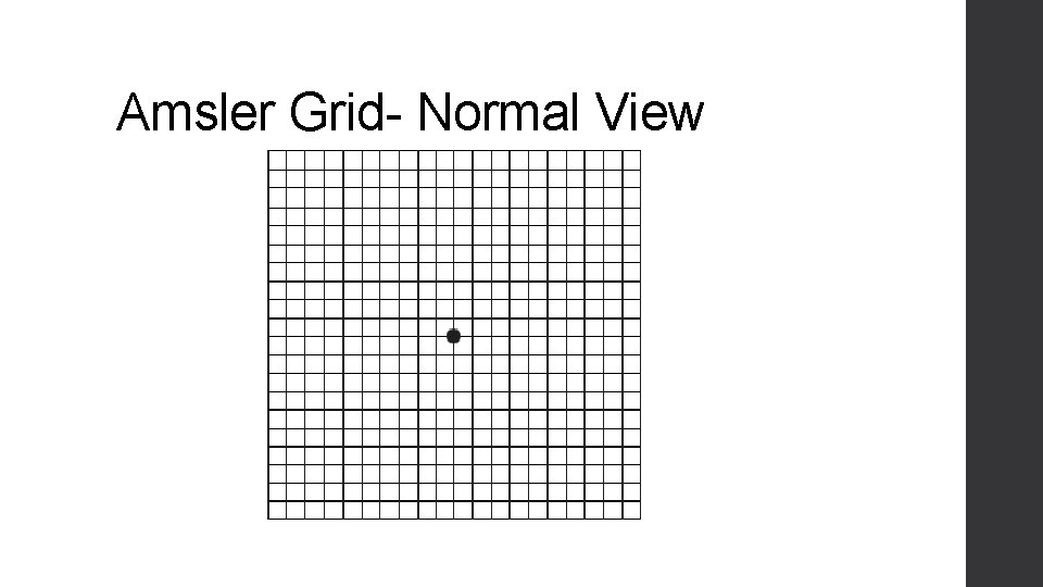 Amsler Grid- Normal View 