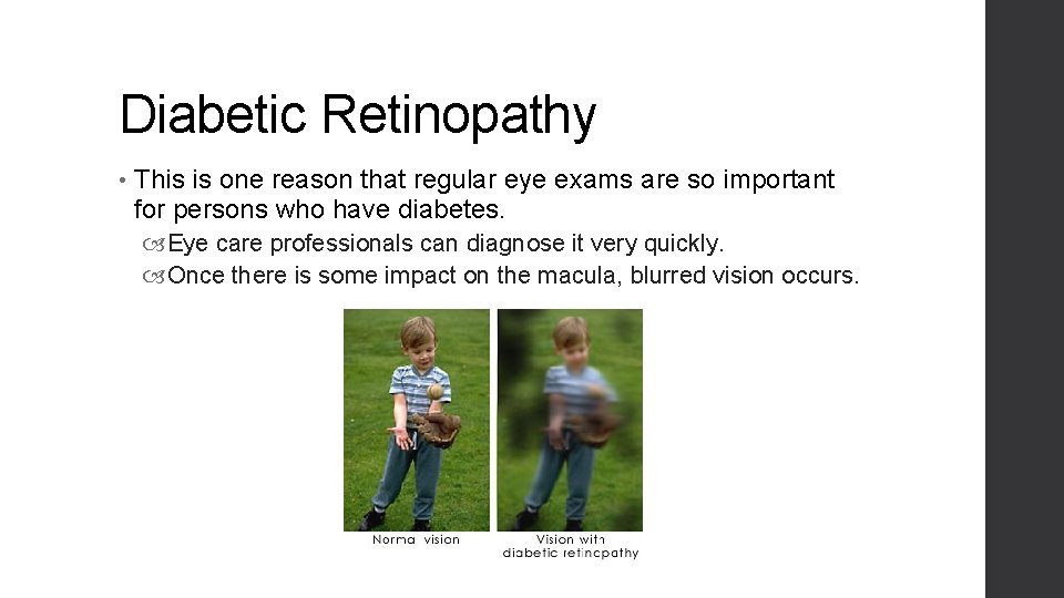 Diabetic Retinopathy • This is one reason that regular eye exams are so important