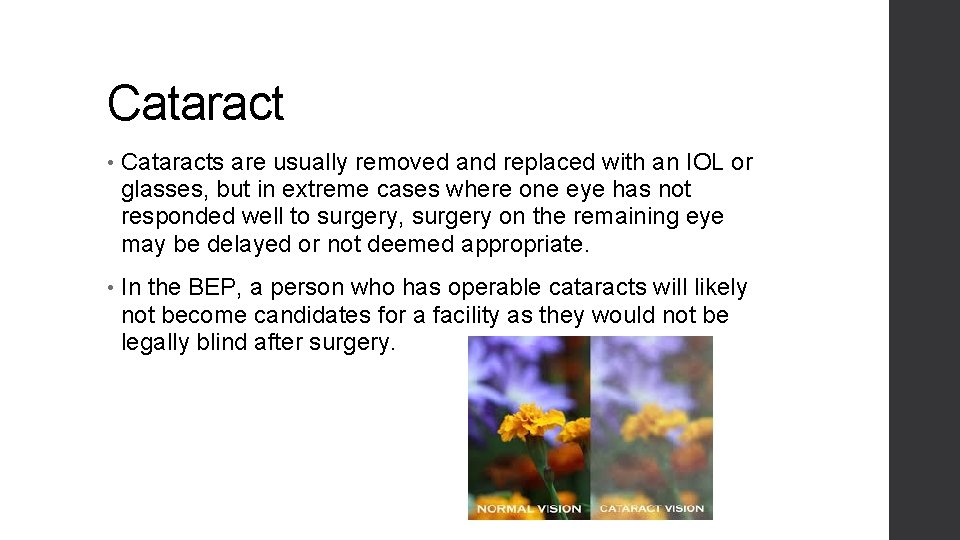 Cataract • Cataracts are usually removed and replaced with an IOL or glasses, but