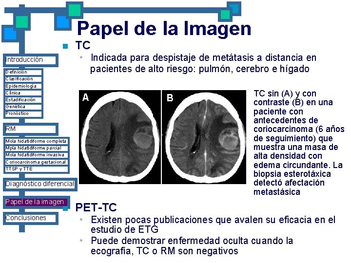 Papel de la Imagen n TC • Indicada para despistaje de metátasis a distancia